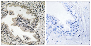 Endophilin B2 rabbit pAb