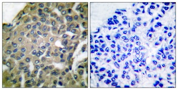 Endoplasmin rabbit pAb