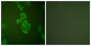 Enolase antibody