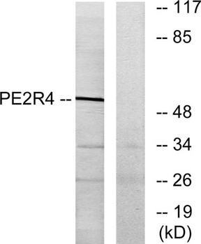 EP4 antibody