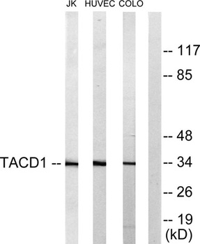 EpCAM antibody