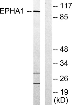 EphA1 antibody