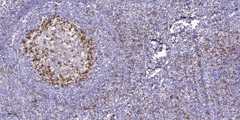 EphA1 antibody