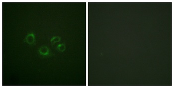 EphA2/3/4 antibody