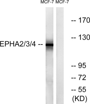 EphA2/3/4 rabbit pAb