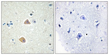 Ephrin-A5 antibody