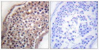 Ephrin-B1/2 rabbit pAb