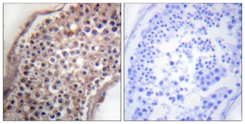 Ephrin-B1/2 antibody