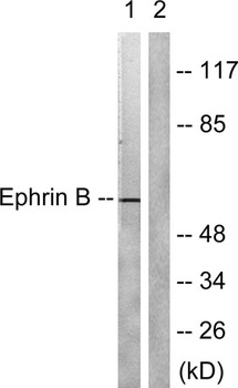 Ephrin-B1/2 rabbit pAb