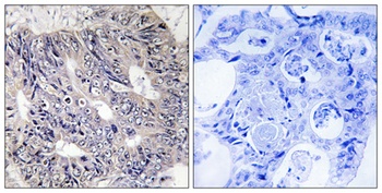 Eps8L1 antibody