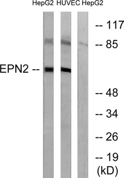 Epsin 2 rabbit pAb Antibody