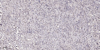 Epsin 2 rabbit pAb Antibody