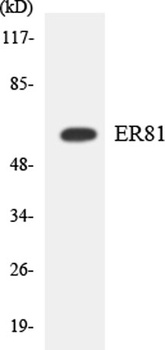 ER81 antibody