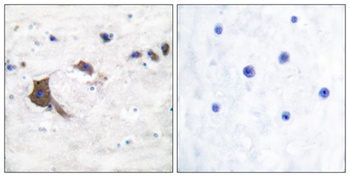 ERAB antibody