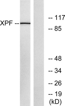 ERCC4 rabbit pAb