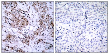 ERα rabbit pAb Antibody