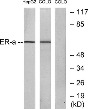 ERα rabbit pAb Antibody