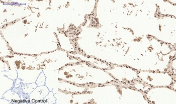 ERalpha antibody