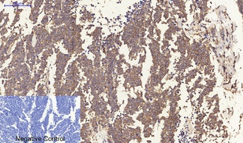 ERbeta antibody