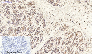 ERbeta antibody