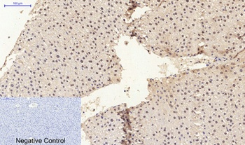 ERbeta antibody