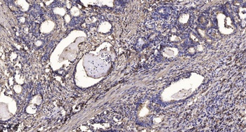 Ethanolamine kinase 2 rabbit pAb