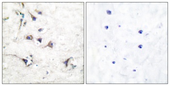 Ezrin antibody