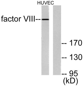 Factor VIII rabbit pAb