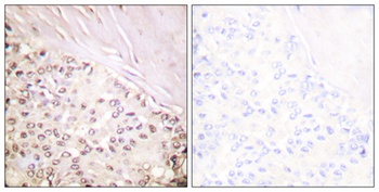 FANCD2 antibody