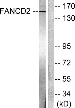 FANCD2 antibody