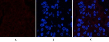 FAS antibody