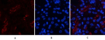 FAS antibody