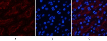 FAS antibody