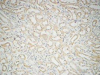 Fatty Acid Synthase rabbit pAb