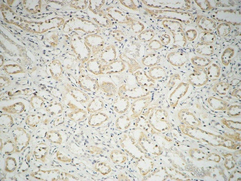 Fatty Acid Synthase antibody