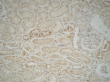 Fatty Acid Synthase rabbit pAb