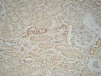 Fatty Acid Synthase antibody