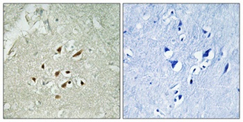 FBP3 antibody