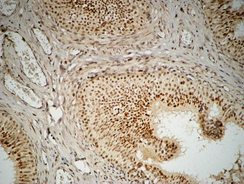 FEN-1 antibody