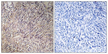 FGF-22 antibody