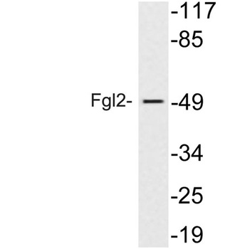 Fgl2 rabbit pAb