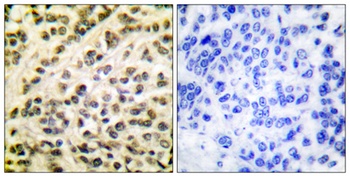 Fli-1 antibody