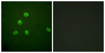 Fos B antibody