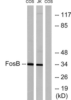 Fos B antibody