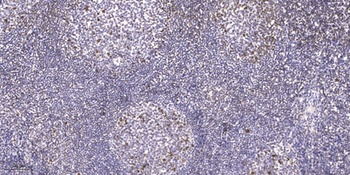 Fos B antibody