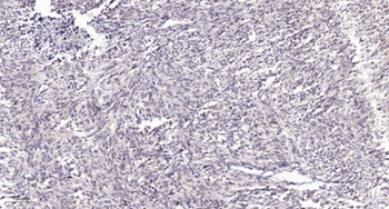 FoxL1 antibody