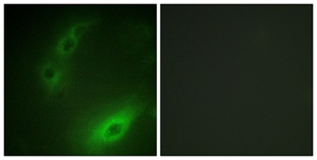 FOXO1A antibody