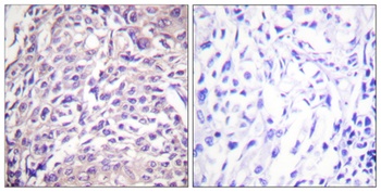 FOXO1A antibody