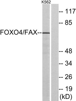 FOXO4 antibody