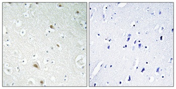 FoxR1 antibody